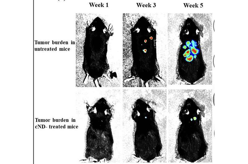 Nanodiamonds can block tumor metastasis in mice, study shows